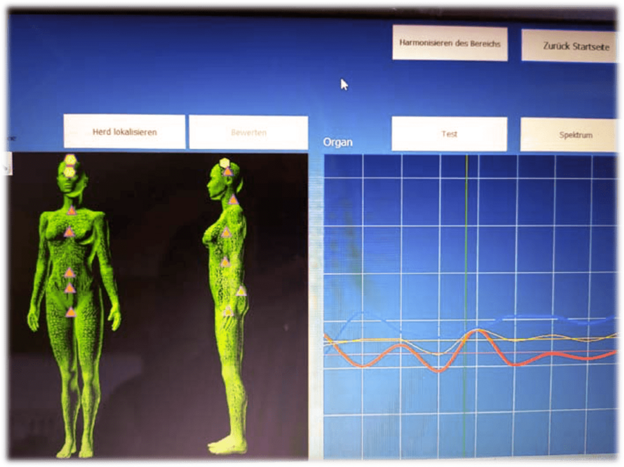 Bioresonanz mit dem Metratronsystem Hunter
